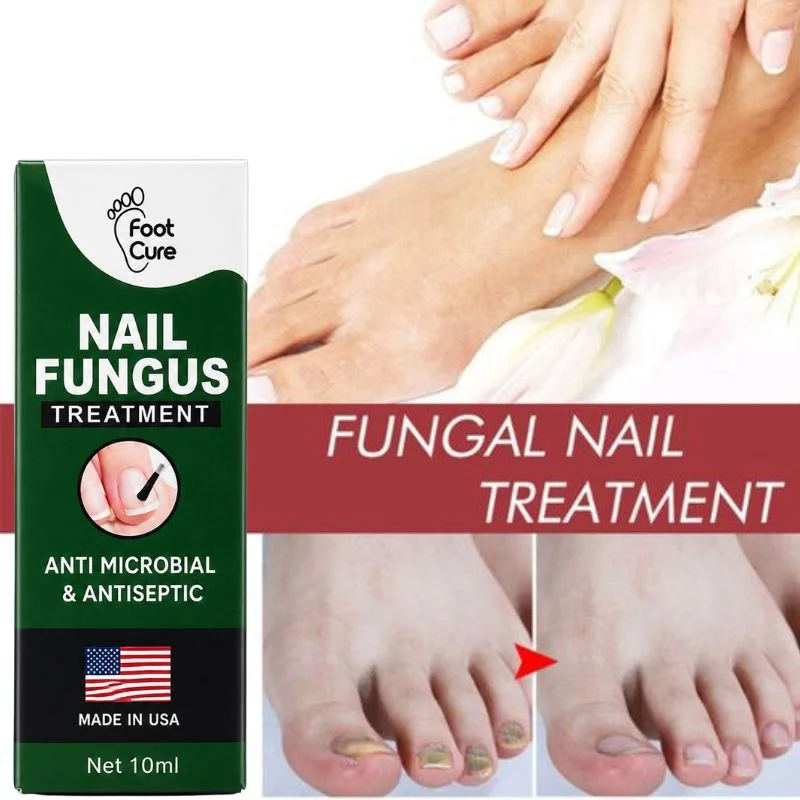 Fast Nail Fungus Treatment Serum | Nail Repair Essence for Fingernails & Toenails | Natural Nail Care Formula - Image 4