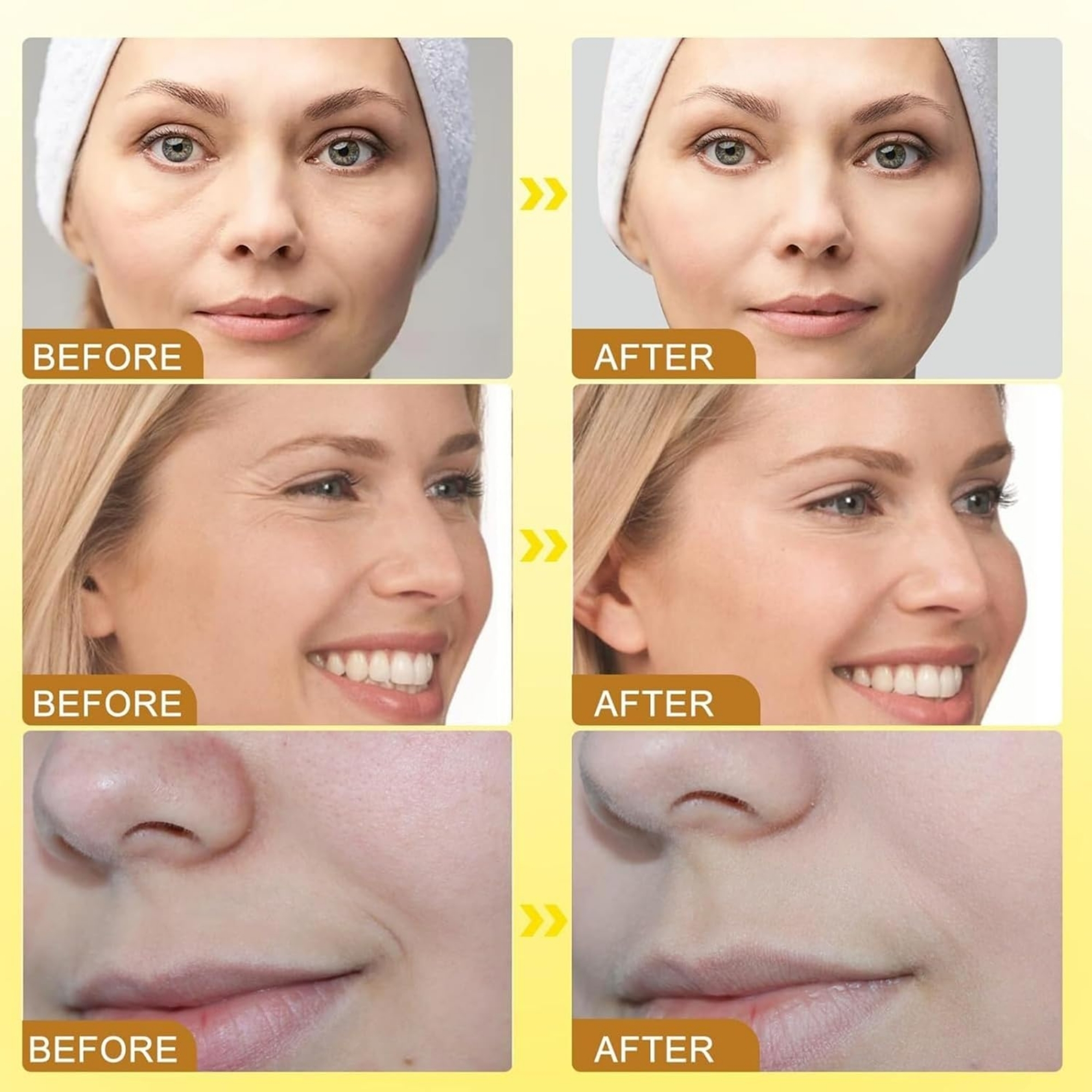 Botox Bee Venom Wrinkle Cream in Pakistan | Anti-Aging & Collagen Boosting Moisturizer - Image 5
